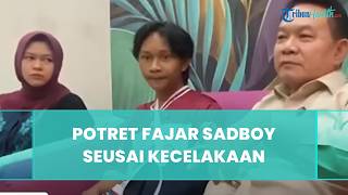 Potret Fajar Sadboy seusai Kecelakaan Motor, Alami Cedera Serius Tangan Retak hingga Pakai Gips