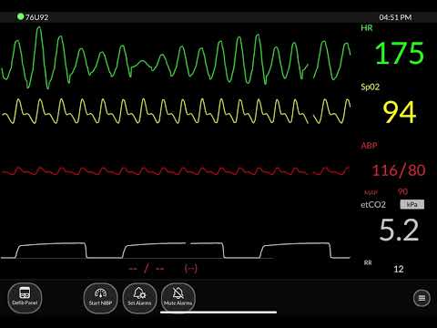 Hospital Monitor Part 2 - ICU