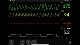 Download lagu Hospital Monitor Part 2 - ICU mp3 Download lagu Hospital Monitor Part 2 - ICU mp3