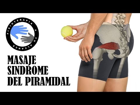 Piriformis syndrome, massage to relieve pain
