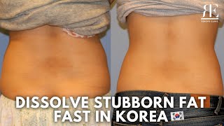 The Best Fat-Dissolving Treatment in Korea | Non-Surgical Body Contouring  | Renovo Skin Clinic