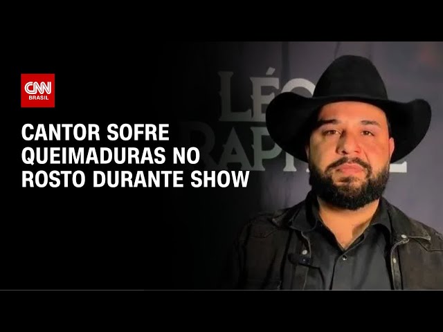 Cantor sertanejo é atingido por fogo durante show no interior de SP | CNN NOVO DIA
