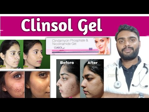 Clinsol Gel Review | Clinsol Gel | Clinsol Gel for Pimples and Acne