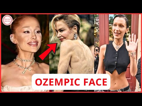 TOP Celebs Suffering From Ozempic Face Before and After Photos | Then and Now 2026
