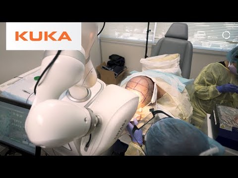 Robotic Hair Restoration Can Improve Millions of Lives | Medical Robotics