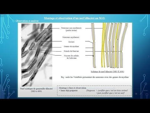 TP Syst  nerveux V3 Nerf
