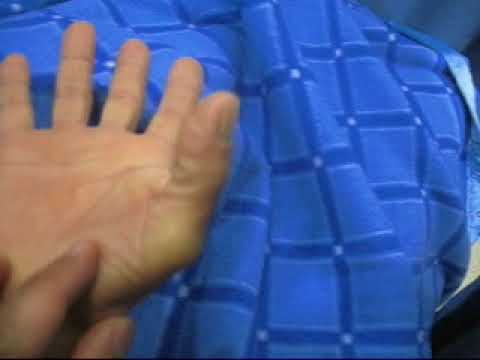 DEDO PULGAR EN GATILLO #juancalbornoz #DEDOGATILLO