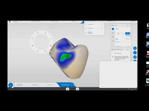 Designing Tooth #12 in CEREC SW 5.1.3