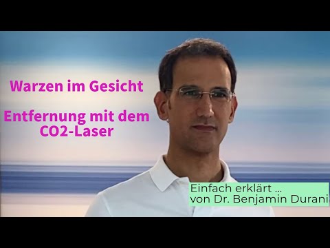 Warzen und Altersflecken im Gesicht, Entfernung mit dem CO2-Laser