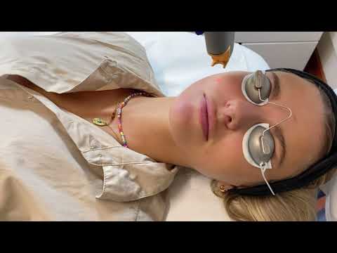 Láser Génesis Tratamiento Facial