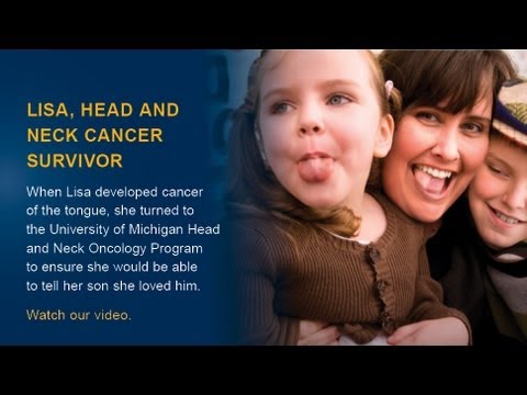 頭頸部がんサバイバーのリサ (Lisa, head and neck cancer survivor)
