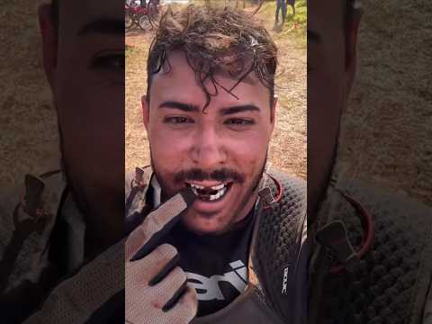 Quebrou o dente Renato Garcia? #shorts