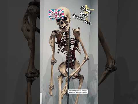 Stone Man Syndrome - where muscles turn to bone 💀 #medicine #explained #creepy #museum #travel