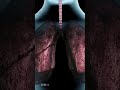 How Exactly Does Smoking Affect the Body