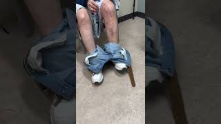 Patient recovery video thumbnail