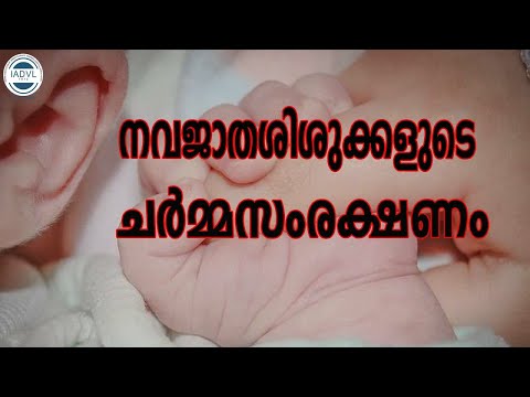 നവജാതശിശുക്കളുടെ ചർമ്മസംരക്ഷണം...Care of newborn s