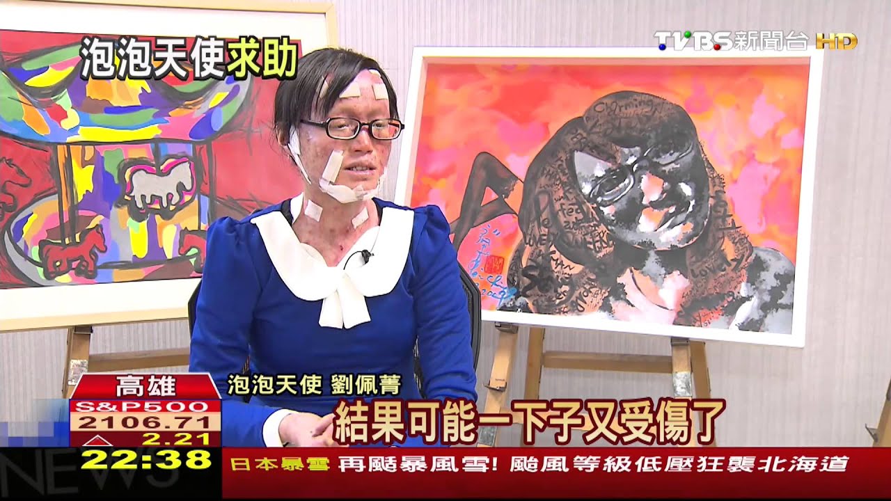 劉佩菁「泡泡天使」 忍傷痛畫貼圖「渴望生命」