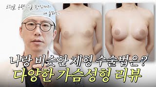 짝가슴도 괜찮아요  다양한 체형의 가슴성형 리뷰 ㅣ Before & After [JPN]