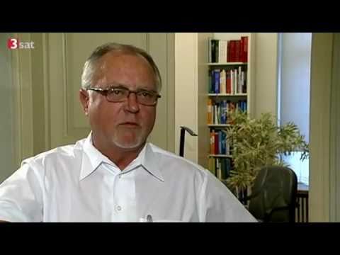 Atopitscheski die Hautentzündung der Erwachsene des Grundes Von der Schuppenflechte auf den Händen auf den Beinen