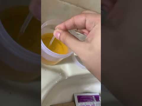 How to use Prega news pregnancy test Faint line or evap line or Positive? Please comment