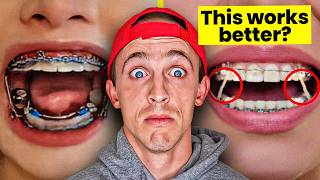 We fixed his teeth with rubber bands (Dentist explains)