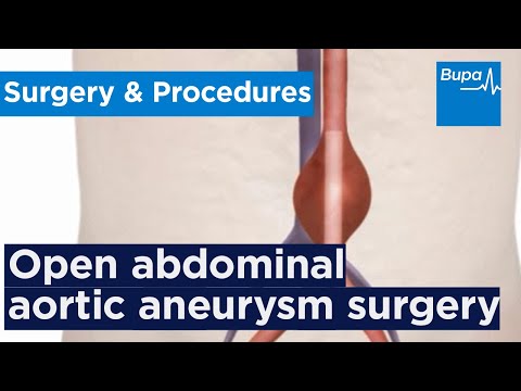 Best ASD Closure Surgery Hospitals in India