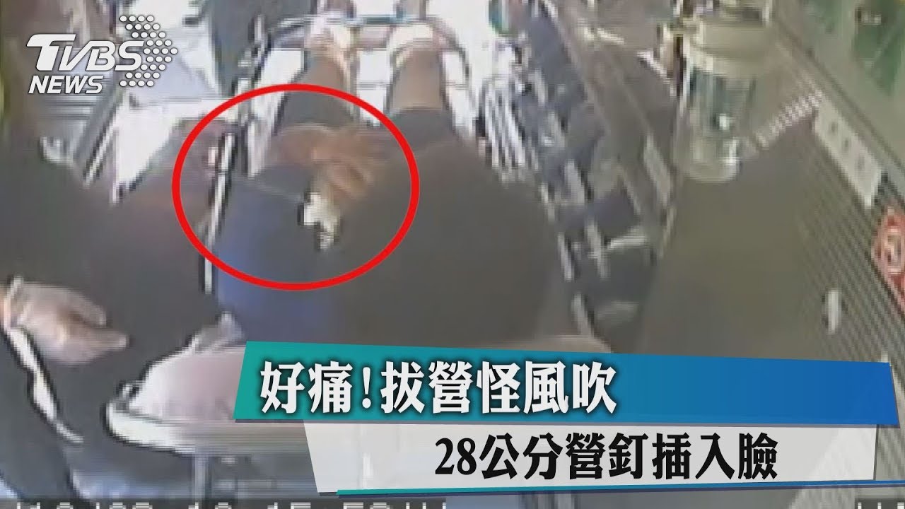 好痛!拔營怪風吹 28公分營釘插入臉