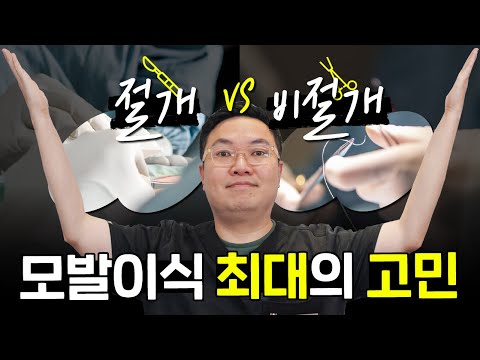 탈모가 있다면 한번쯤은 하는 고민! | 모발이식 절개vs비절개