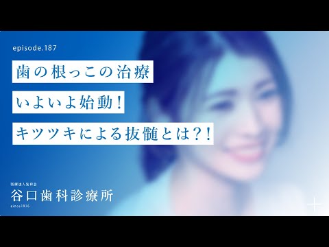 第187話 歯の根っこの治療–いよいよ始動❗️天然歯によるキツツキで抜髄とは⁉️-手動に比べて、実際どうなの⁉️