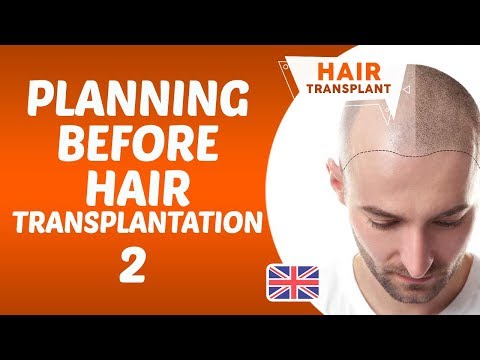 Planning Before Hair Transplantation2 - Dr Hamid AYDIN