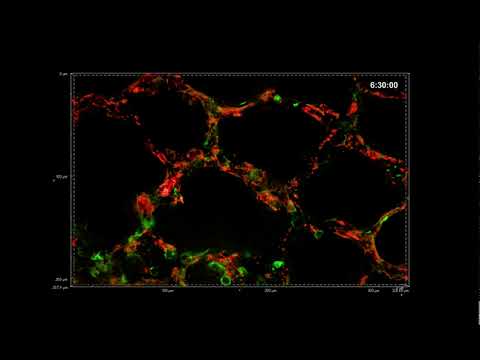 Imagem do epitélio (verde) e da rede capilar (vermelho) em uma fatia de tecido pulmonar pós-natal