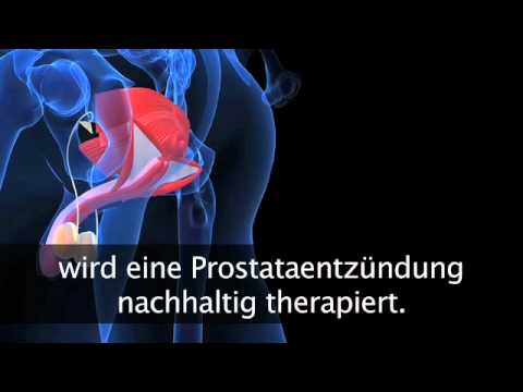 Prostata-Therapie Volksmedizin Forum Härtbar oder nicht Prostatitis