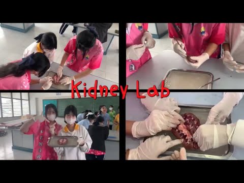 Vlog kidney lab | Ma tam lab tai kun