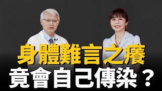 身上難言之癢竟是黴菌惹禍！香港腳會傳到胯下？皮膚科醫揭「自己傳染自己」驚人真相！｜ft. 楊志勛｜祝你健康