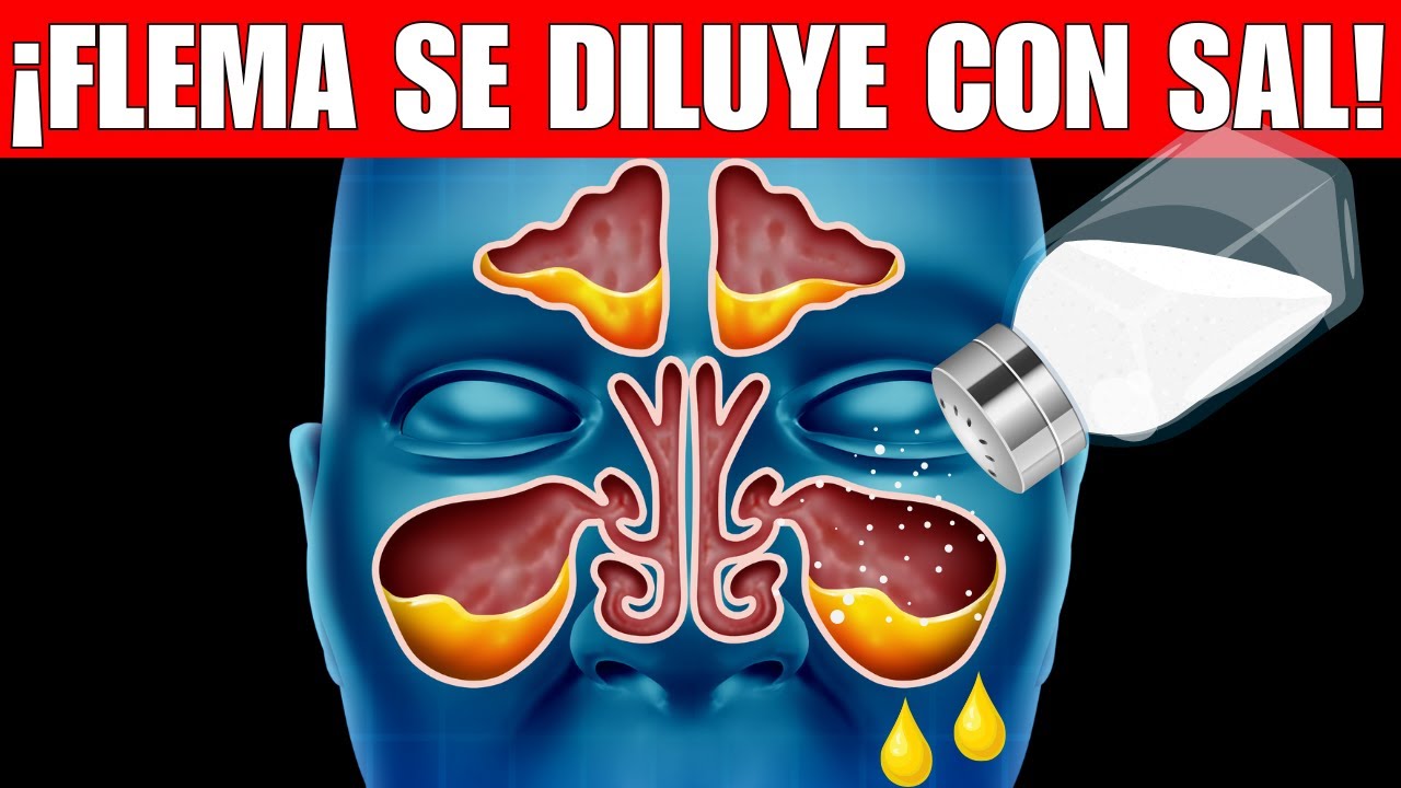 Elimina RÁPIDO la FLEMA en la GARGANTA ¡NO más MOCO!