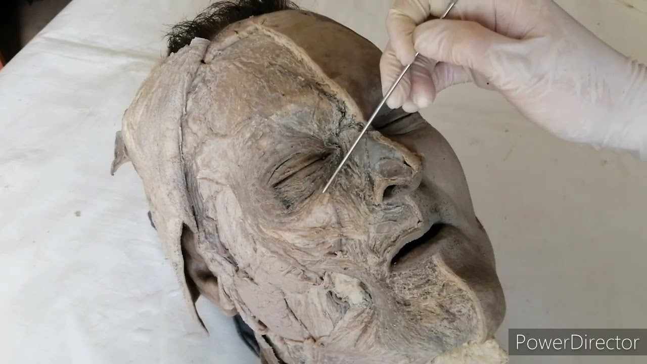 TP N° 24 Miología de la cabeza músculos de la mímica  Ayudante alumna Sofia Barth Soria