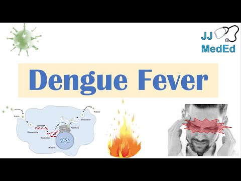 Dengue Fever | Pathophysiology, Symptoms, Diagnosis & Treatment