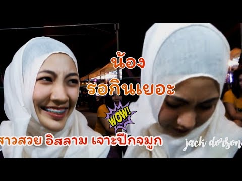 ราคาหน้าอกขยาย เพิ่มความคิดเห็น hyaluronan เต้านม