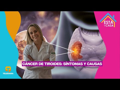 Cáncer de tiroides: síntomas y causas