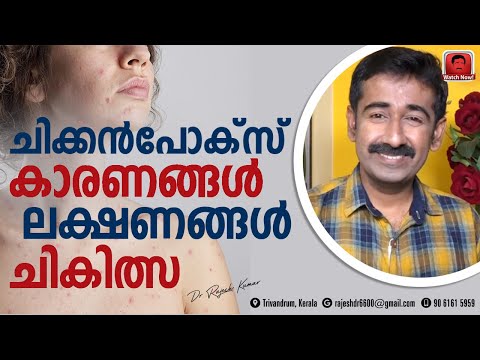 Chickenpox Causes, Symptoms & Treatment