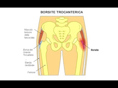 Care medicamente îmbunătățesc circulația sângelui în osteochondroza cervicală