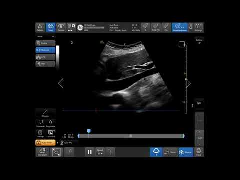 Venue™ Family R3 Tutorial - Auto IVC