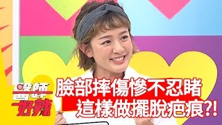 林彥君臉部摔傷慘不忍睹！「這樣做」輕鬆擺脫疤痕？！【醫師好辣】 20190618  part1 EP759 田知學 阿諾