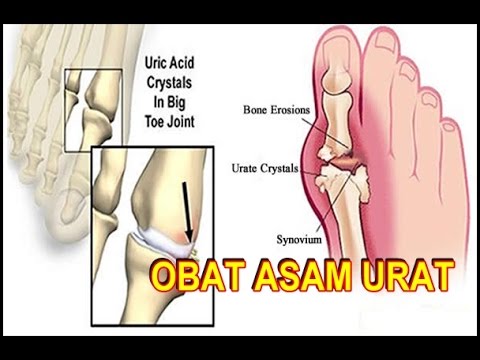 Obat Amerika untuk potensi Memang benar bahwa pria bertubuh kecil kontol kecil