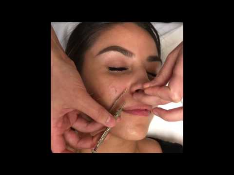 Cosmetic Facial Acupuncture Treatment