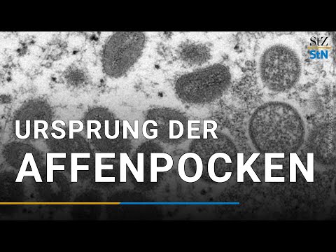 Woher kommen die Affenpocken?