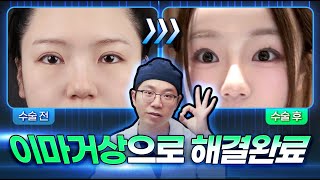 20,30대 이마거상 해도 될까요? 이마거상하는 이유 ❗