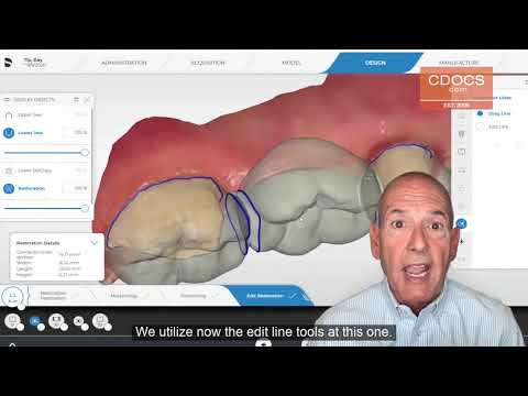 Tip of the Day: Anatomic Connector Line Edits