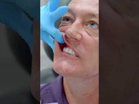 Protect Your Dental Implants: Brushing, Flossing & Maintenance Guide 