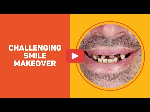 download lagu mp3 mp4 Teeth Midline Shift, download lagu Teeth Midline Shift gratis, unduh video klip Teeth Midline Shift